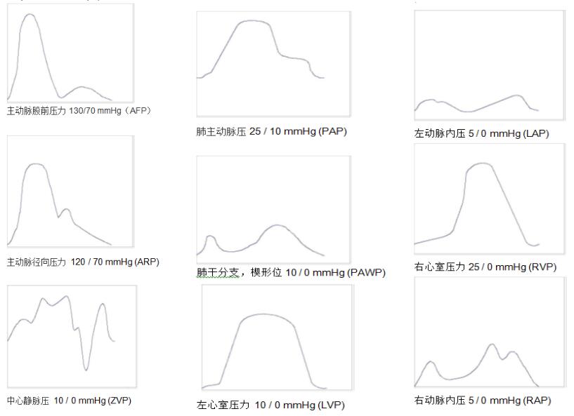 SPL 400型 体温 心输出量 有创血压模拟器2.jpg