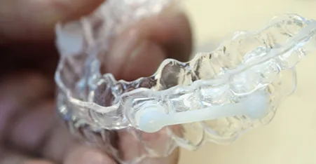 隐形正畸矫治器.jpg 隐形正畸矫治器.jpg