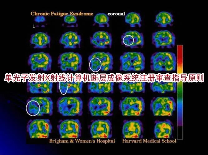 《单光子发射X射线计算机断层成像系统注册审查指导原则》正式发布（附全文）